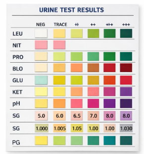 Urine test results colour chart
